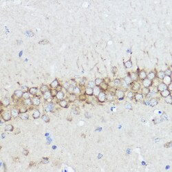 Invitrogen ABI1 Polyclonal Antibody 100 μL; Unconjugated:Antibodies,