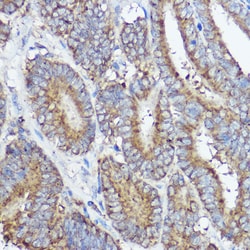 Invitrogen ABI1 Polyclonal Antibody 100 μL; Unconjugated:Antibodies,
