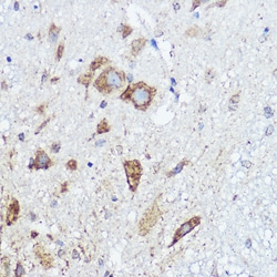 Invitrogen ABI1 Polyclonal Antibody 100 μL; Unconjugated:Antibodies,