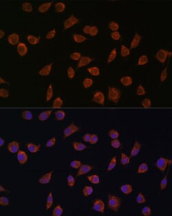Invitrogen ACSS1 Polyclonal Antibody 100 &mu;L; Unconjugated:Antibodies,