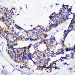 Invitrogen ACSS1 Polyclonal Antibody 100 &mu;L; Unconjugated:Antibodies,
