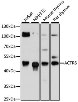 Invitrogen ACTR6 Polyclonal Antibody 100 &mu;L; Unconjugated:Antibodies,
