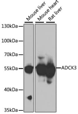 Invitrogen CABC1 Polyclonal Antibody 100 &mu;L; Unconjugated:Antibodies,