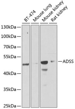 Invitrogen ADSS Polyclonal Antibody 100 &mu;L; Unconjugated:Antibodies,