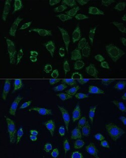 Invitrogen AEBP1 Polyclonal Antibody 100 μL; Unconjugated:Antibodies,