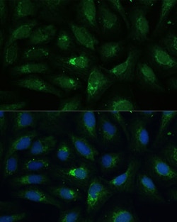 Invitrogen AEBP1 Polyclonal Antibody 100 μL; Unconjugated:Antibodies,