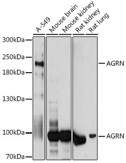 Invitrogen Agrin Polyclonal Antibody 100 &mu;L; Unconjugated:Antibodies,
