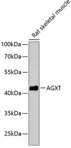 Invitrogen AGXT Polyclonal Antibody 100 &mu;L; Unconjugated:Antibodies,