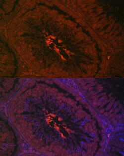 Invitrogen AKAP4 Polyclonal Antibody 100 &mu;L; Unconjugated:Antibodies,