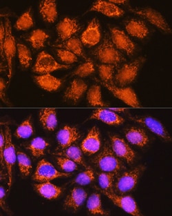 Invitrogen ALDH1B1 Polyclonal Antibody 100 &mu;L; Unconjugated:Antibodies,