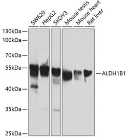 Invitrogen ALDH1B1 Polyclonal Antibody 100 &mu;L; Unconjugated:Antibodies,