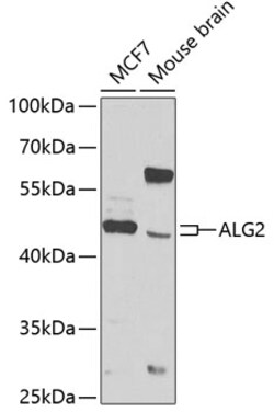 Invitrogen ALG2 Polyclonal Antibody 100 &mu;L | Buy Online | Invitrogen&trade; | Fisher Scientific