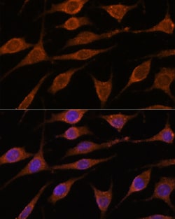 Invitrogen ALG5 Polyclonal Antibody 100 &mu;L | Buy Online | Invitrogen&trade; | Fisher Scientific
