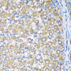 Invitrogen ALG5 Polyclonal Antibody 100 &mu;L | Buy Online | Invitrogen&trade; | Fisher Scientific