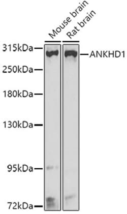 Invitrogen ANKHD1 Polyclonal Antibody 100 &mu;L; Unconjugated:Antibodies,