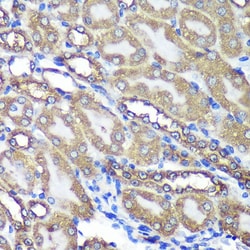 Invitrogen ANKLE2 Polyclonal Antibody 100 &mu;L; Unconjugated:Antibodies,