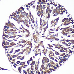 Invitrogen ANKLE2 Polyclonal Antibody 100 &mu;L; Unconjugated:Antibodies,