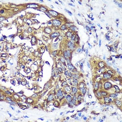 Invitrogen ANKLE2 Polyclonal Antibody 100 &mu;L; Unconjugated:Antibodies,