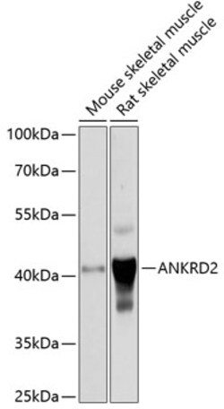 Invitrogen ANKRD2 Polyclonal Antibody 100 μL; Unconjugated:Antibodies,