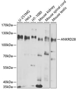 Invitrogen ANKRD28 Polyclonal Antibody 100 &mu;L; Unconjugated:Antibodies,