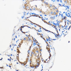 Invitrogen ANT1/ANT2/ANT3/ANT4 Polyclonal Antibody 100 &mu;L; Unconjugated:Antibodies,