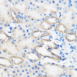 Invitrogen ANT1/ANT2/ANT3/ANT4 Polyclonal Antibody 100 &mu;L; Unconjugated:Antibodies,
