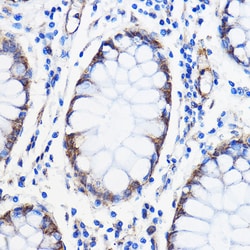 Invitrogen ANT1/ANT2/ANT3/ANT4 Polyclonal Antibody 100 &mu;L; Unconjugated:Antibodies,