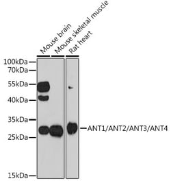 Invitrogen ANT1/ANT2/ANT3/ANT4 Polyclonal Antibody 100 &mu;L; Unconjugated:Antibodies,