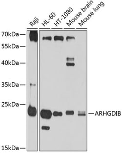 Invitrogen D4-GDI Polyclonal Antibody 100 &mu;L; Unconjugated:Antibodies,