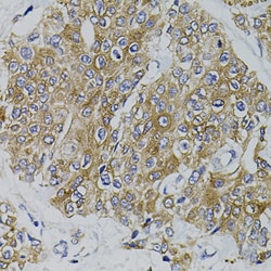Invitrogen ARHGEF11 Polyclonal Antibody 100 &mu;L; Unconjugated:Antibodies,