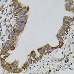 Invitrogen ARHGEF11 Polyclonal Antibody 100 &mu;L; Unconjugated:Antibodies,