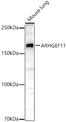 Invitrogen ARHGEF11 Polyclonal Antibody 100 &mu;L; Unconjugated:Antibodies,