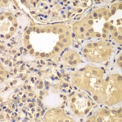 ARNT2 Polyclonal Antibody, Invitrogen 100 &mu;L; Unconjugated:Antibodies,