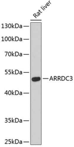 Invitrogen ARRDC3 Polyclonal Antibody 100 &mu;L; Unconjugated:Antibodies,