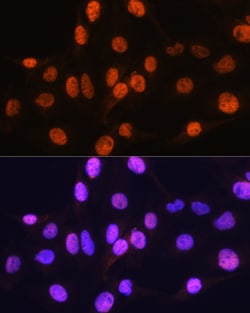 Invitrogen ARX Polyclonal Antibody 100 &mu;L; Unconjugated:Antibodies,