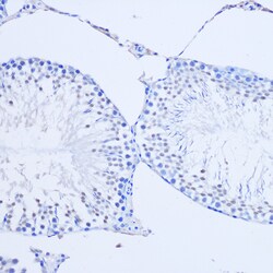 Invitrogen ARX Polyclonal Antibody 100 &mu;L; Unconjugated:Antibodies,