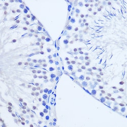 Invitrogen ARX Polyclonal Antibody 100 &mu;L; Unconjugated:Antibodies,