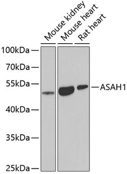Invitrogen ASAH1 Polyclonal Antibody 100 &mu;L; Unconjugated:Antibodies,