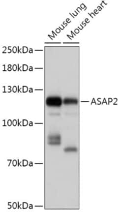 Invitrogen ASAP2 Polyclonal Antibody 100 &mu;L | Buy Online | Invitrogen&trade; | Fisher Scientific