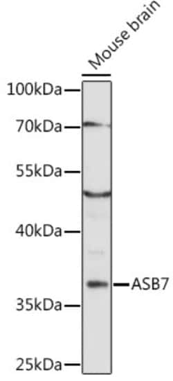 Invitrogen ASB7 Polyclonal Antibody 100 &mu;L | Buy Online | Invitrogen&trade; | Fisher Scientific