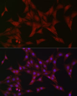 Invitrogen ATF5 Polyclonal Antibody 100 &mu;L; Unconjugated:Antibodies,