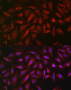 Invitrogen ATF5 Polyclonal Antibody 100 &mu;L; Unconjugated:Antibodies,