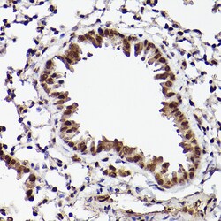 Invitrogen ATF5 Polyclonal Antibody 100 &mu;L; Unconjugated:Antibodies,