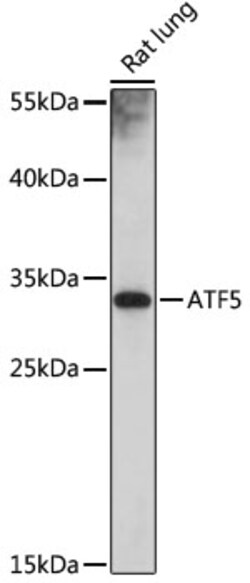 Invitrogen ATF5 Polyclonal Antibody 100 &mu;L; Unconjugated:Antibodies,