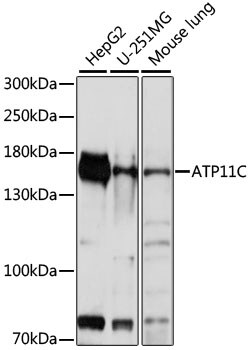 Invitrogen ATP11C Polyclonal Antibody 100 &mu;L; Unconjugated:Antibodies,