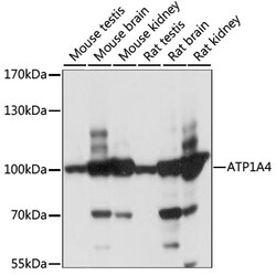 Invitrogen ATP1A4 Polyclonal Antibody 100 &mu;L; Unconjugated:Antibodies,