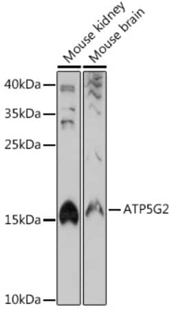 Invitrogen ATP5G2 Polyclonal Antibody 100 μL; Unconjugated:Antibodies,