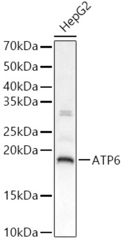Invitrogen MT-ATP6 Polyclonal Antibody 100 &mu;L | Buy Online | Invitrogen&trade; | Fisher Scientific