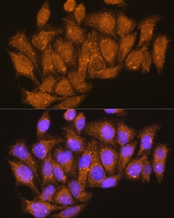 Invitrogen ATP6V1E1 Polyclonal Antibody 100 &mu;L; Unconjugated:Antibodies,
