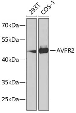 Invitrogen AVPR2 Polyclonal Antibody 100 &mu;L; Unconjugated:Antibodies,